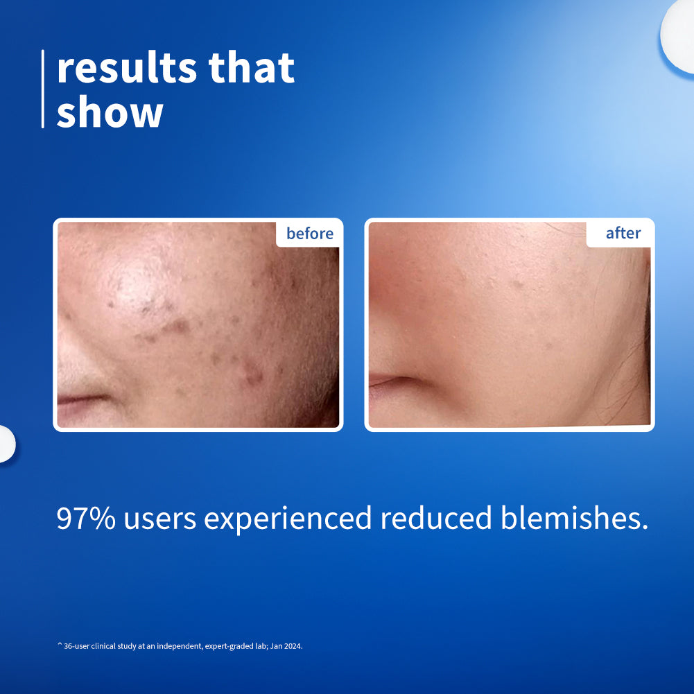 Plum 10% Niacinamide & Rice Water Brightening Face Serum | Brightens From 1st Use | 2X Instant Hydration | Dermat-Tested, 50ml