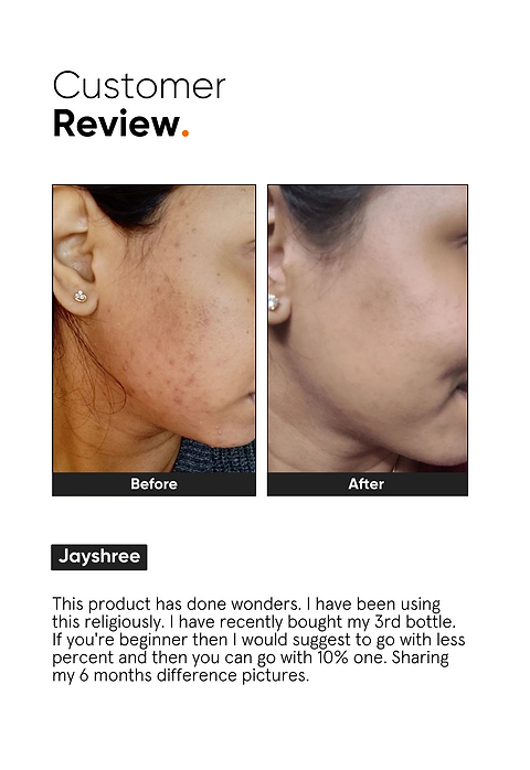 Minimalist Niacinamide 10% Face Serum For  reducing sebum &amp; pores, and even skin tone, 10ml - Image 6 - Buy from Indicrest