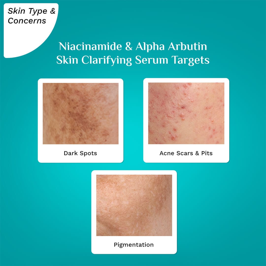 Pilgrim Niacinamide & Alpha Arbutin Skin Clarifying Serum, 30ml - Image 6 - Buy from Indicrest