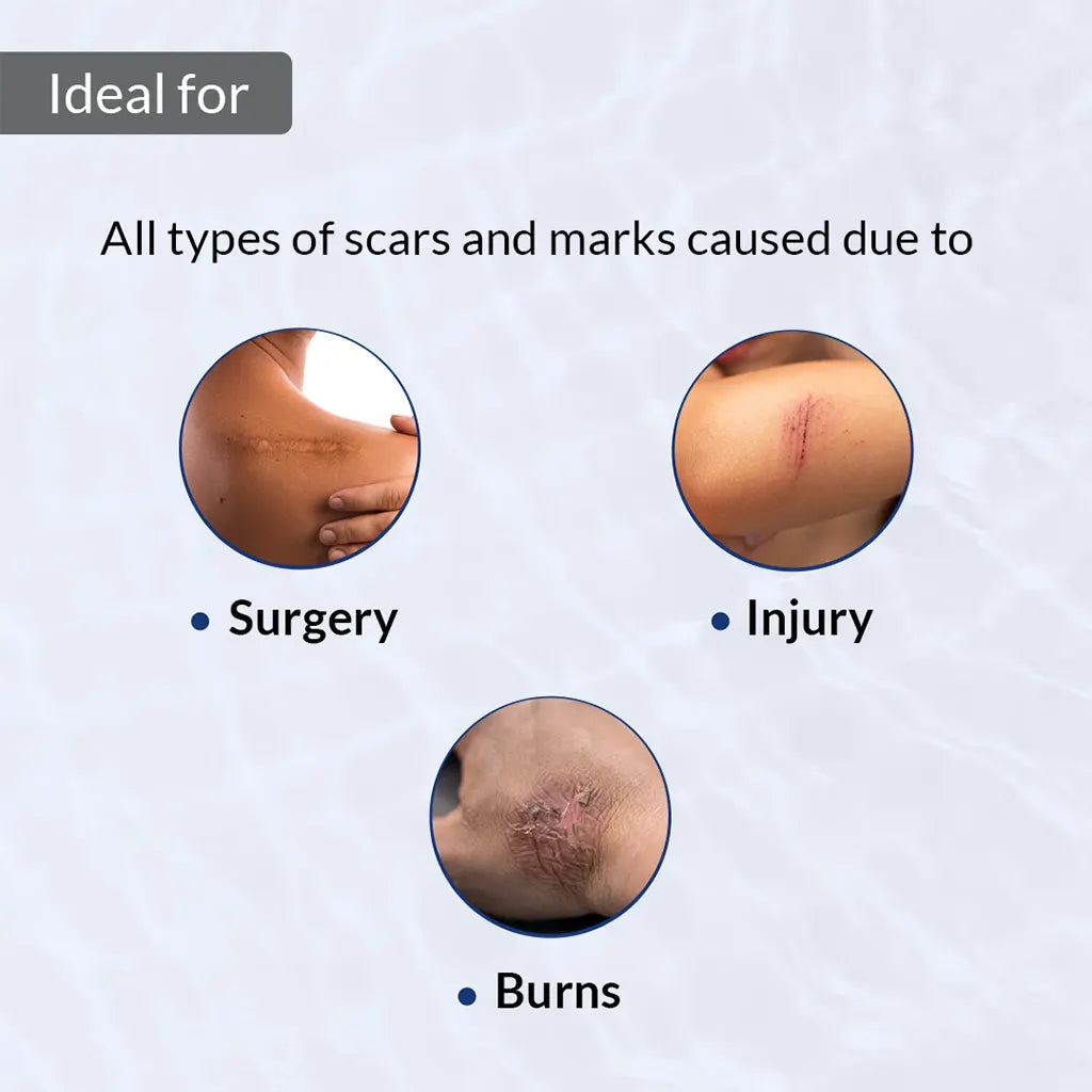 Fixderma Scar Gel for Scars | Gel-based treatment to fade stubborn scars & marks, 15ml - Image 3 - Buy from Indicrest
