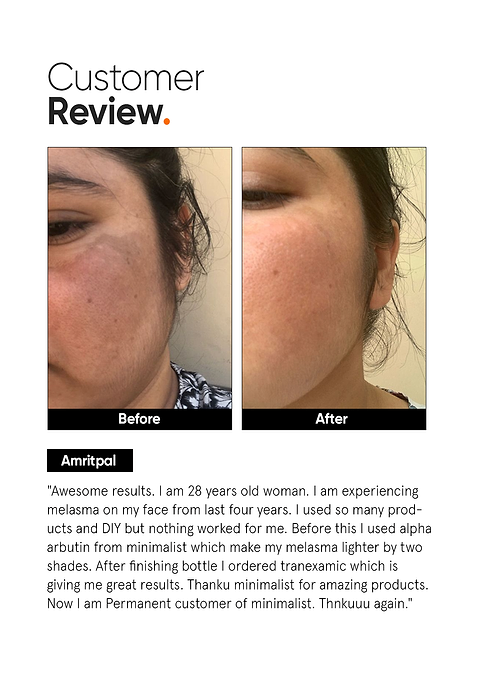 Minimalist Tranexamic 3% Face Serum For Reduces Melasma, PIE, PIH &amp; Scars, 30ml - Image 5 - Buy from Indicrest