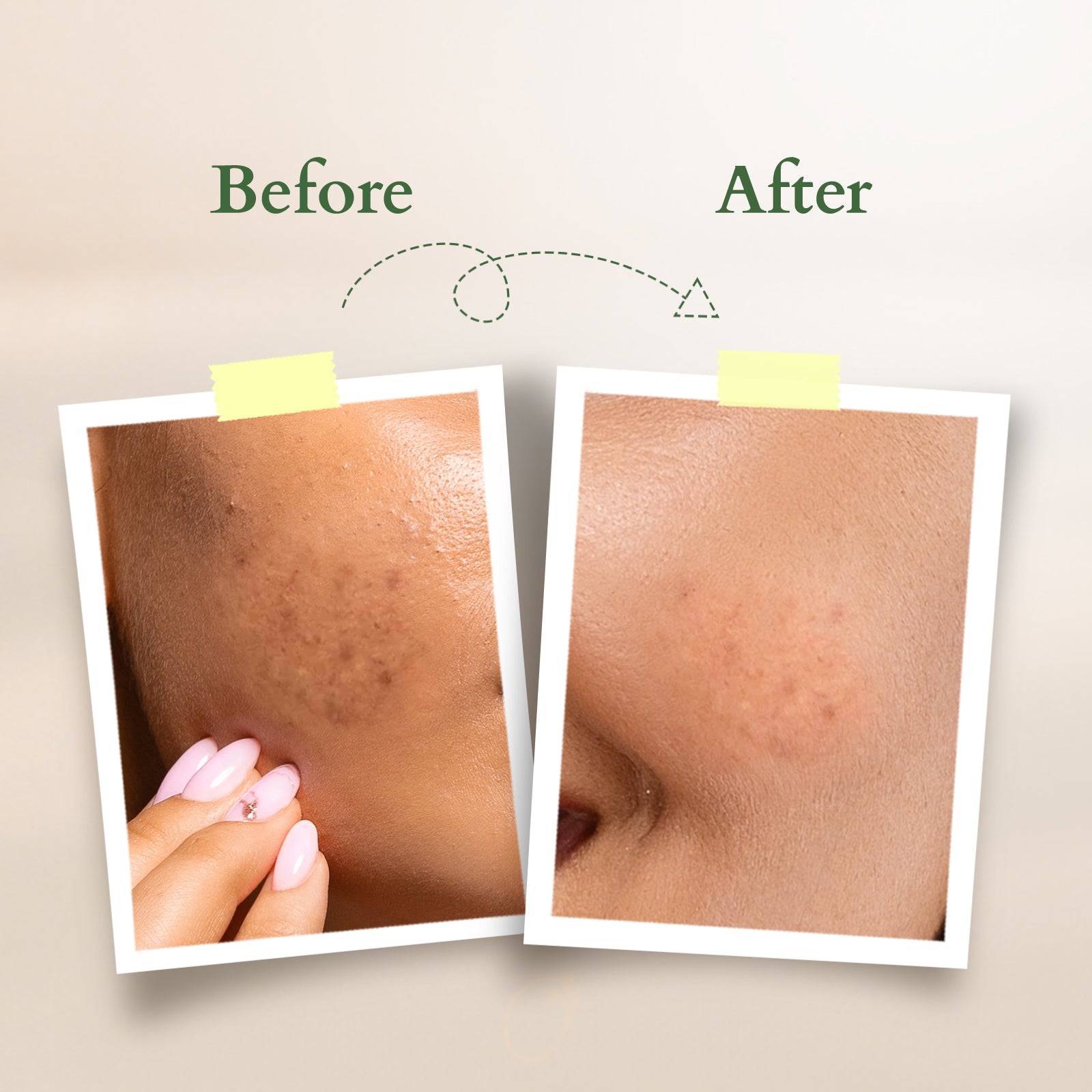 Lotus Herbals Organics+ Vitamin-C Radiance Booster Cleanser, 100g