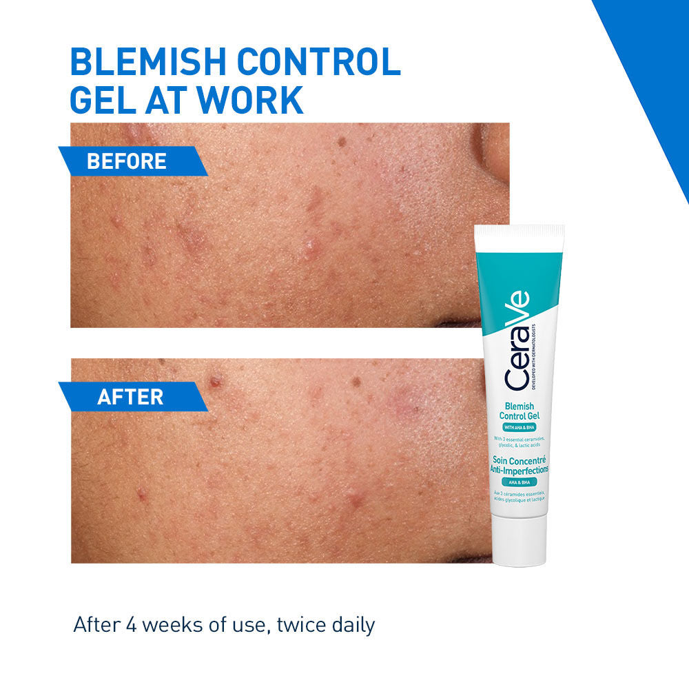 CeraVe Blemish Control Gel with 2% Salicylic Acid, AHA & Niacinamide for Acne Spot Treatment, 40ml Buy at Indicrest Image 4