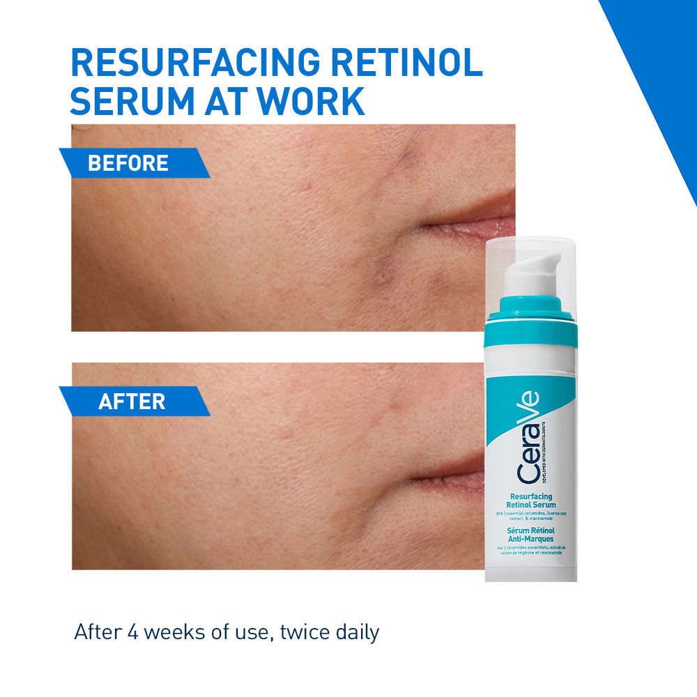 CeraVe Resurfacing Retinol Serum, Reduces Acne Marks with Licorice Root Extract & Niacinamide, 30ml Buy at Indicrest Image 4