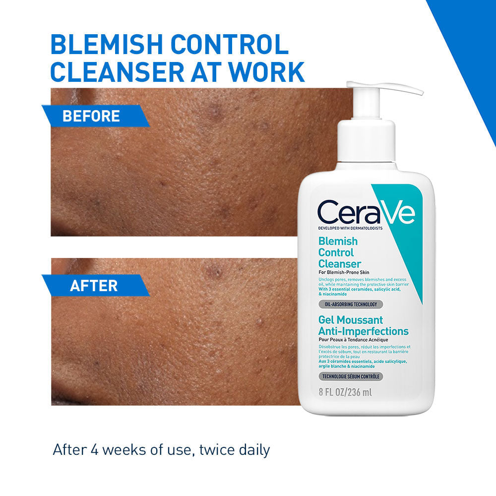 CeraVe Blemish Control Cleanser with 2% Salicylic Acid & Niacinamide for Acne-prone skin, 236ml Buy at Indicrest Image 4