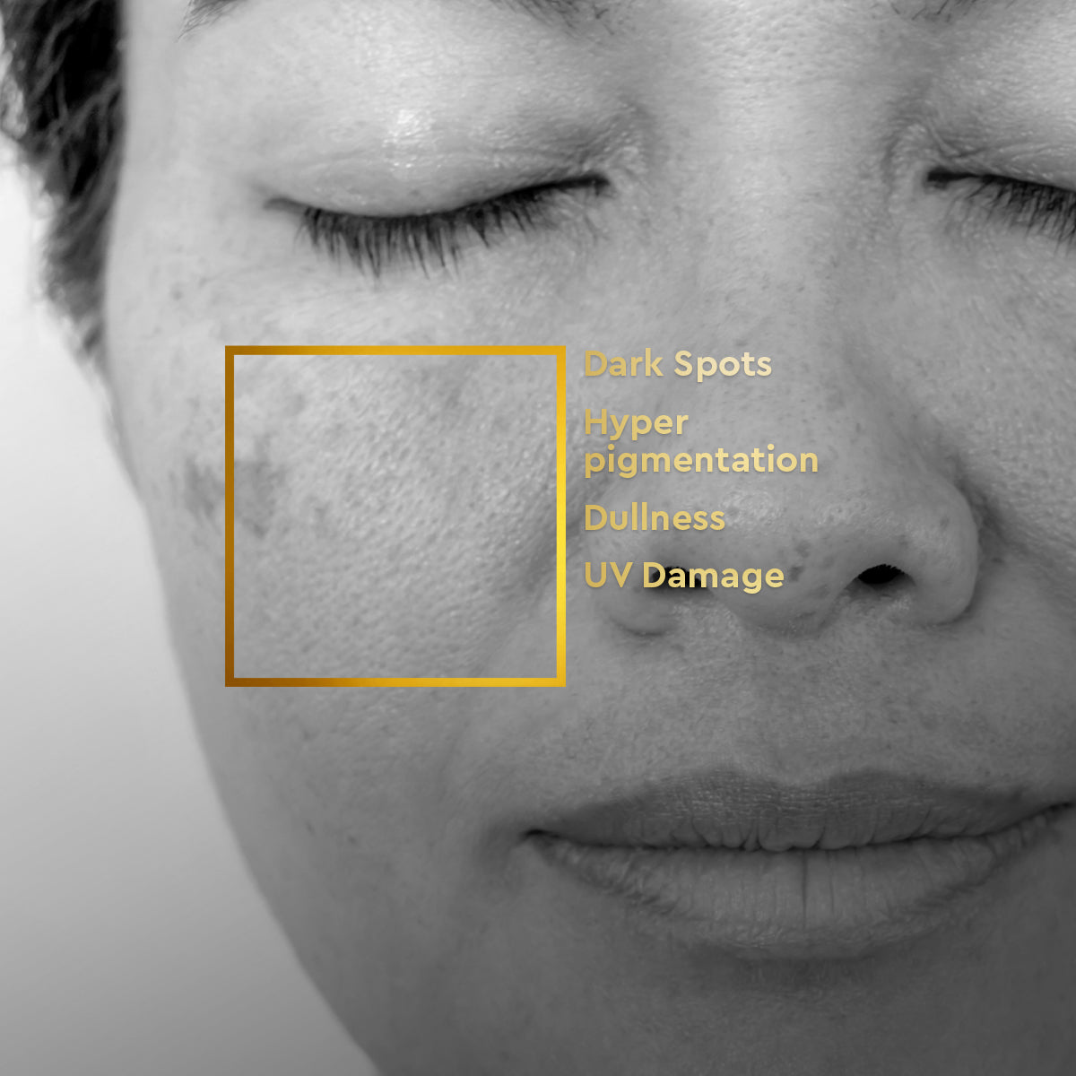 VLCC Anti Pigmentation Regime - Image 2 - Buy from Indicrest