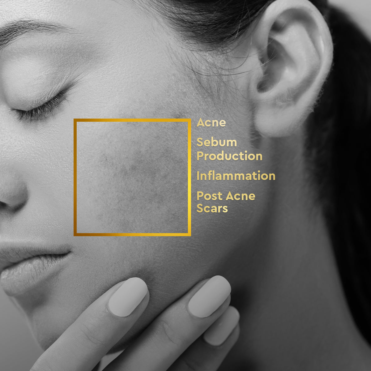 VLCC Anti Acne Regime - Image 2 - Buy from Indicrest