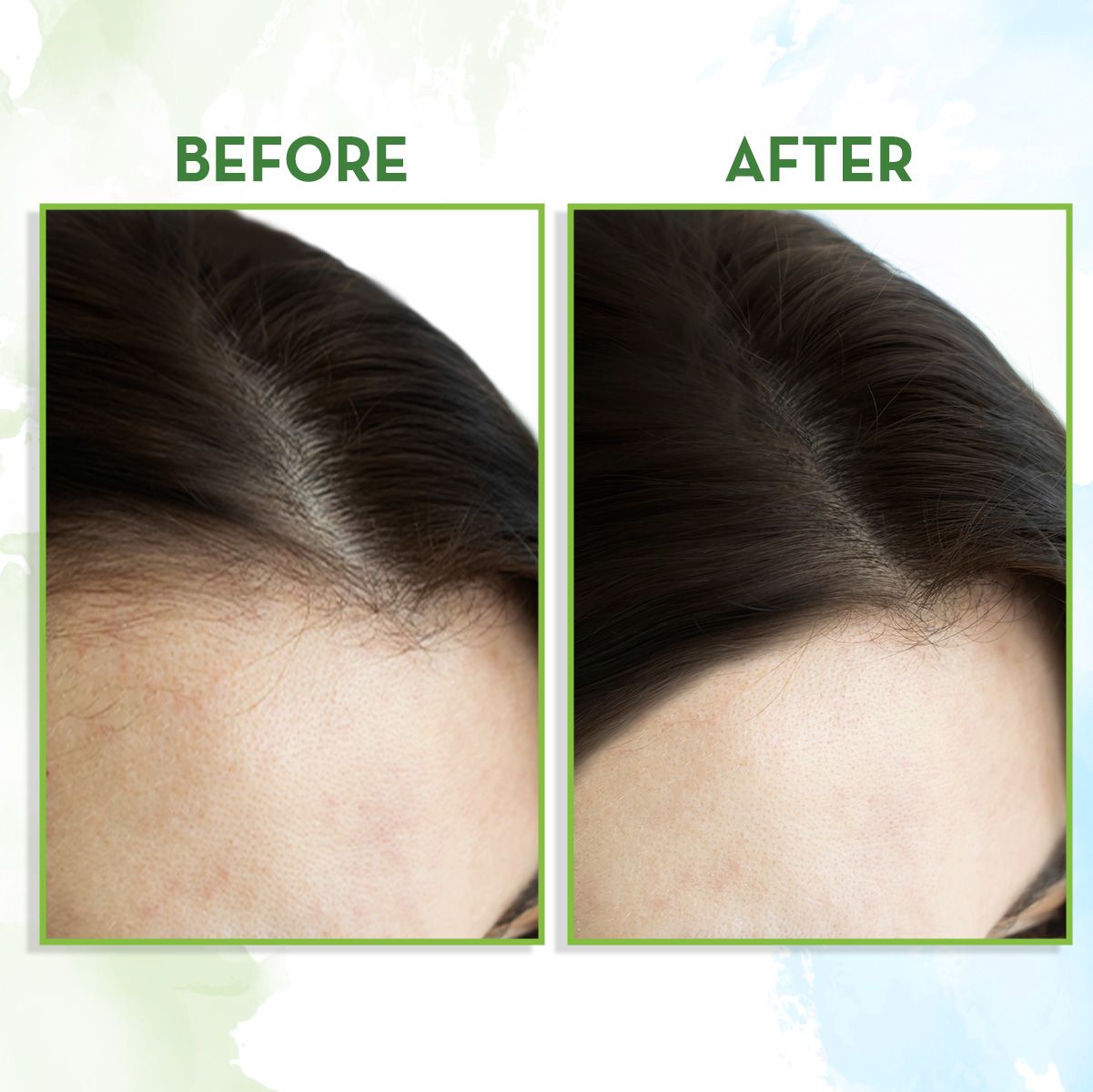 Mamaearth Rosemary Essential Oil for Hair Growth, 15ml - Image 6 - Buy from Indicrest