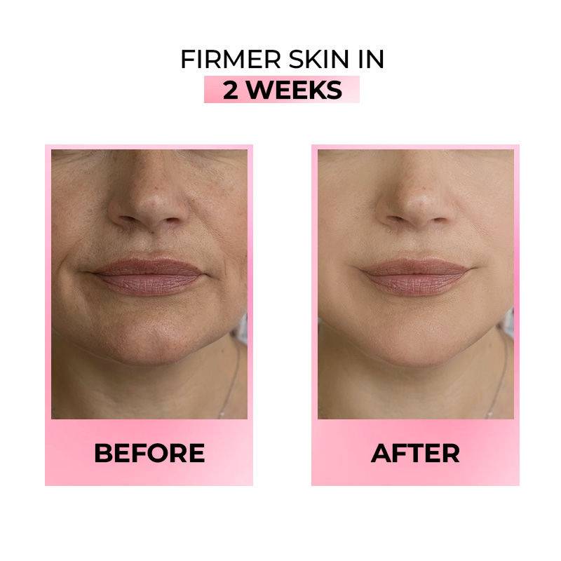 Streax Youthful Shine Face Serum With 11% Retinol Peptide Complex, Reduces Fine Lines & Wrinkles, 30ml Buy at Indicrest Image 6