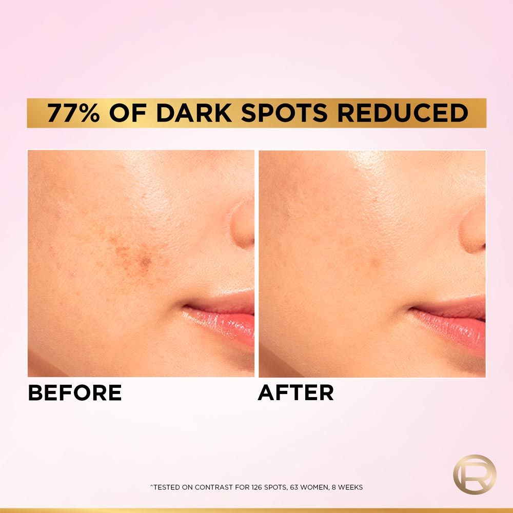 L'Oreal Paris Glycolic Bright 8% [Melasyl + Niacinamide] Face Serum for Brightening Dark Spots, 15ml Buy at Indicrest Image 7