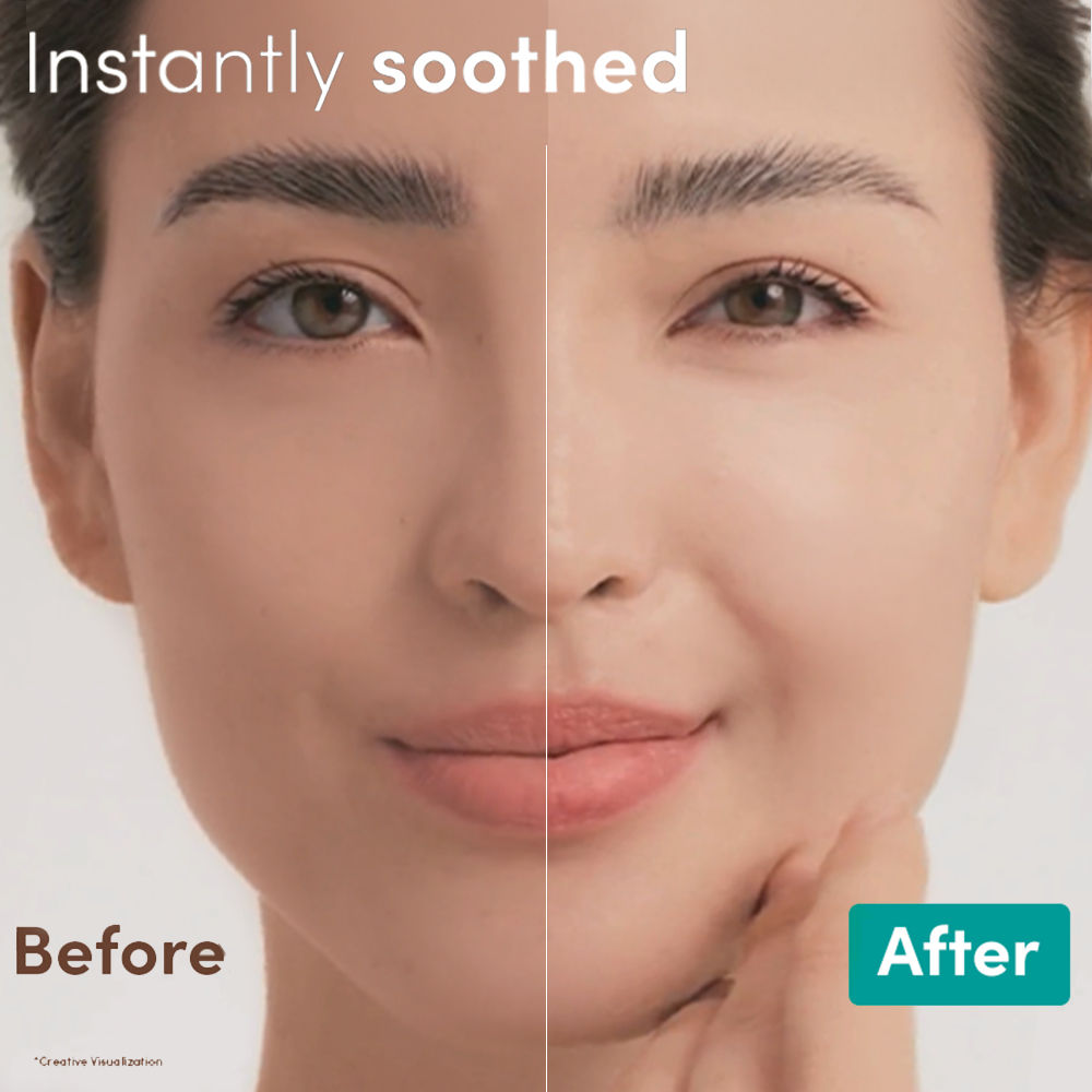 Aveeno Calm + Restore Hydrating Oat Face Serum Normal Dry Sensitive Skin Dermat Recommended, 30ml
