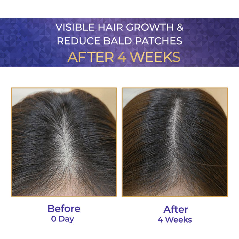 Streax Vitagrowth Hair Serum with 3% Redensyl, 3% Anagain, 3% Baicapil, Biotin & Caffeine, 30ml Buy at Indicrest Image 3