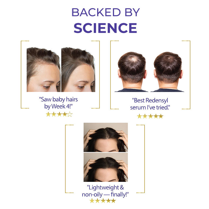 Streax Vitagrowth Hair Serum with 3% Redensyl, 3% Anagain, 3% Baicapil, Biotin & Caffeine, 30ml Buy at Indicrest Image 7
