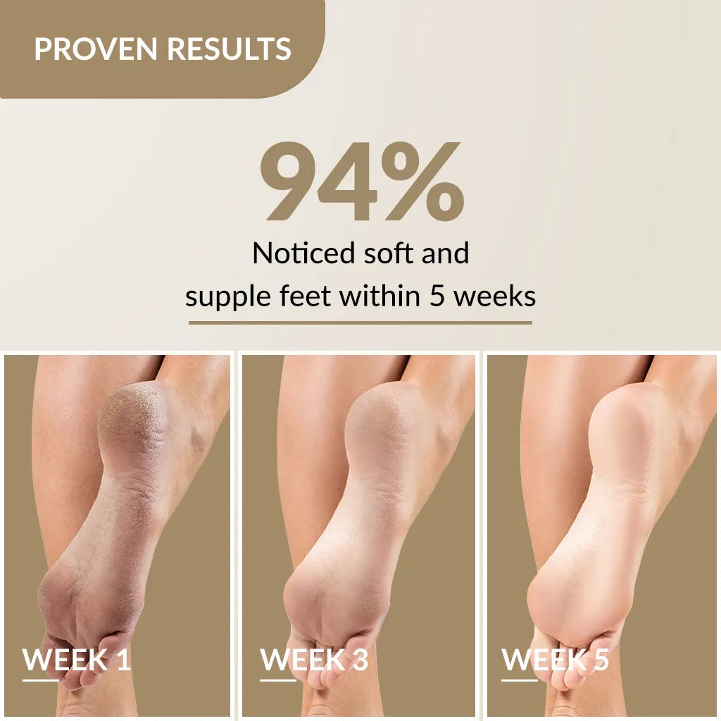 Fixderma Foobetik Foot Cream 50g, 50g - Image 4 - Buy from Indicrest