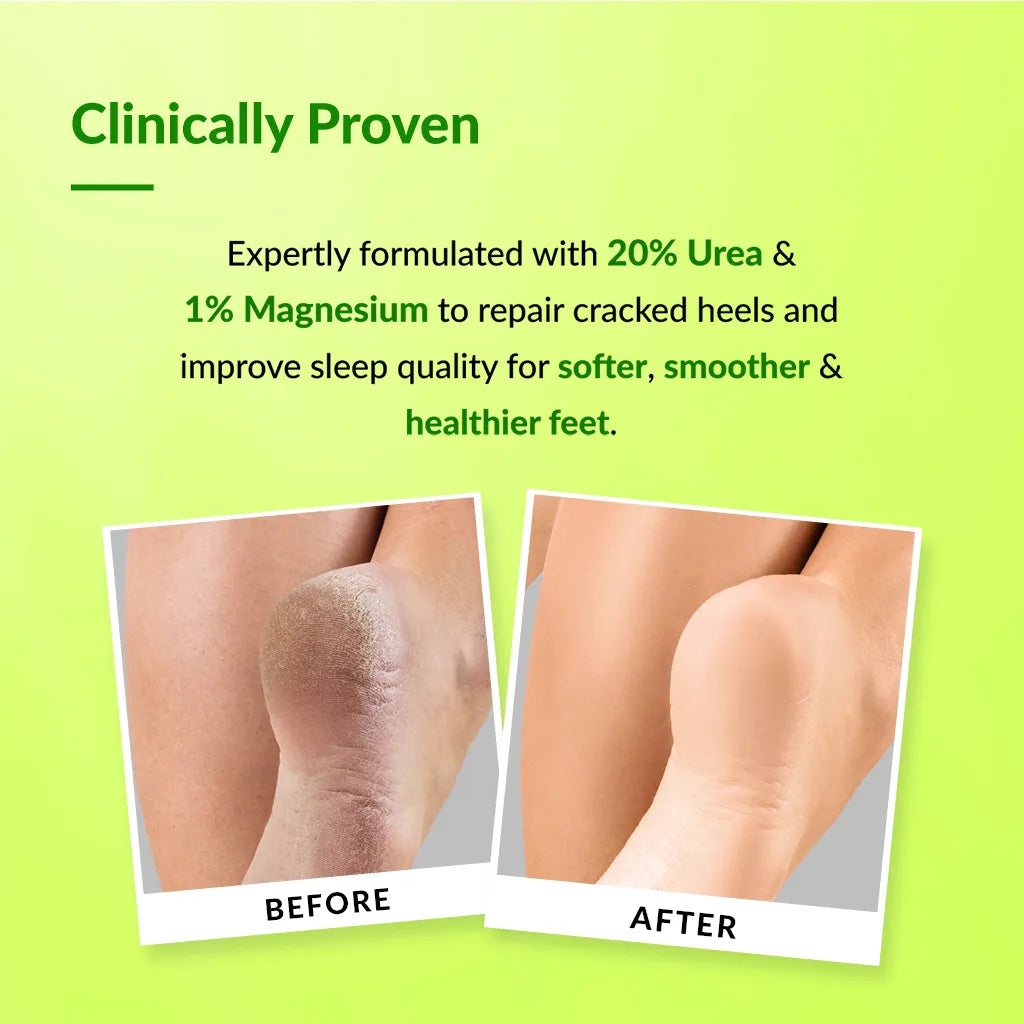 Fixderma Foobetik Foot Cream Roll On, 60ml - Image 2 - Buy from Indicrest