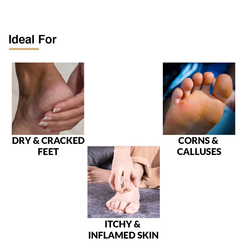 Fixderma Nigrifix Cream & Foot Cream | Targeted Treatment for Pigmentation and Cracked Heels, Nigrifix Cream 100g + Foot Cream 60g - Image 5 - Buy from Indicrest