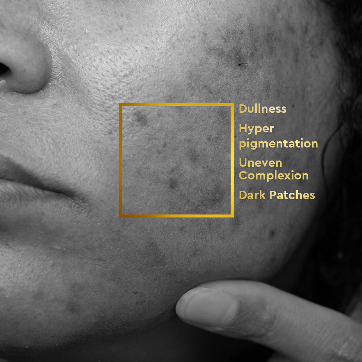 VLCC Glow Bright Everyday Regime - Skin Brightening, Discoloration and Anti-Pigmentation - Image 2 - Buy from Indicrest