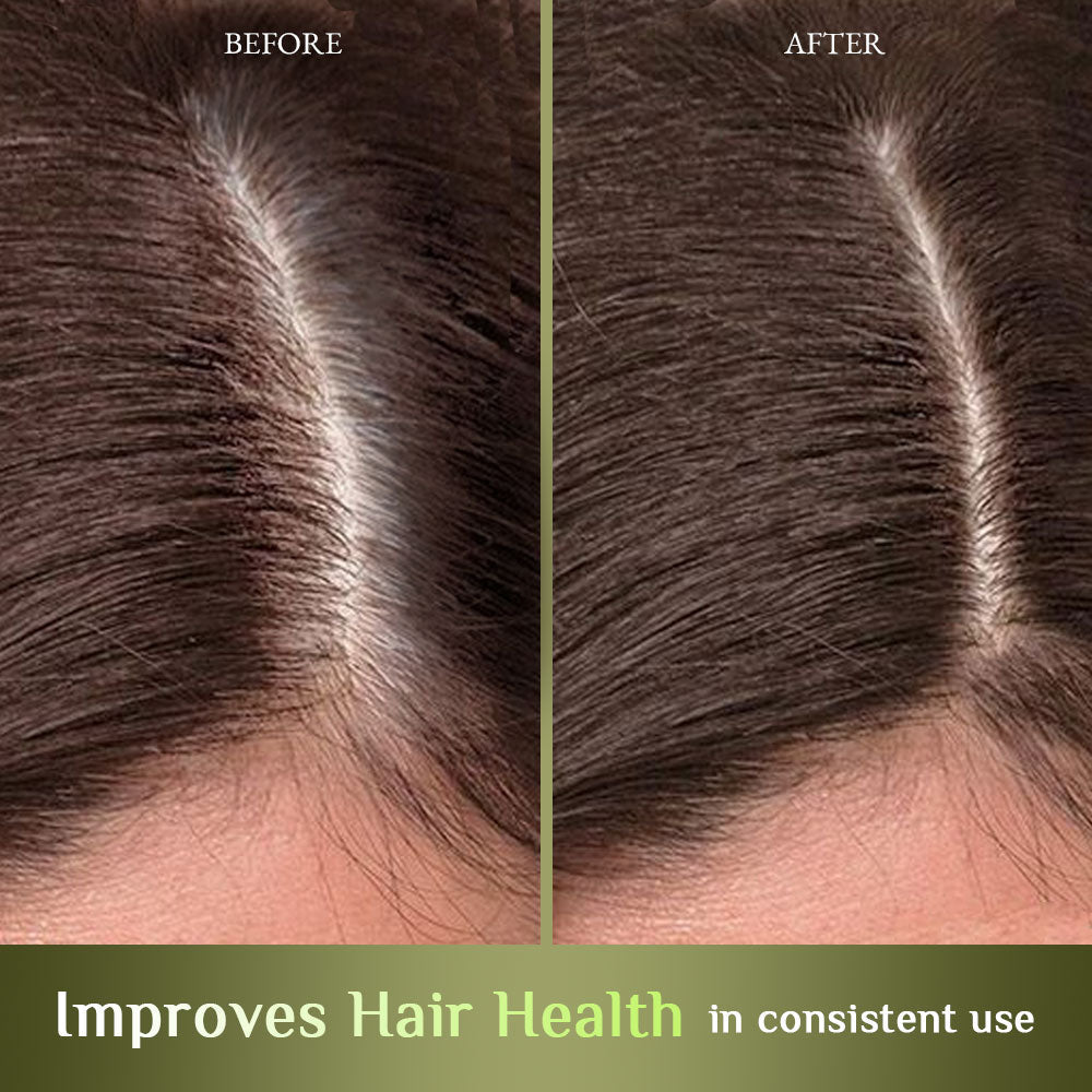 Richfeell Hair Nourisher 10 ml Pack of 3 - Image 6 - Buy from Indicrest