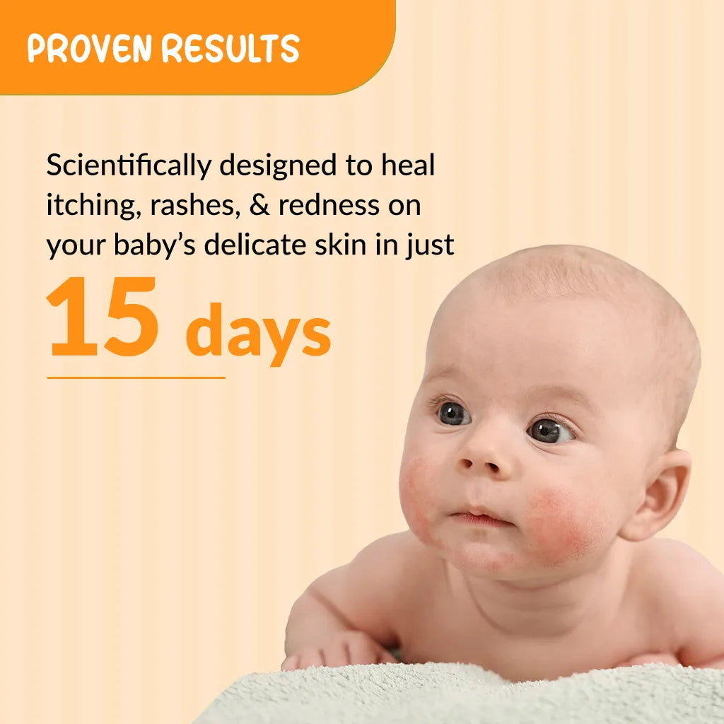Fixderma Hoopoe Anti Itch Lotion | Instant Relief From Itching & Redness For Babies, 100ml - Image 4 - Buy from Indicrest