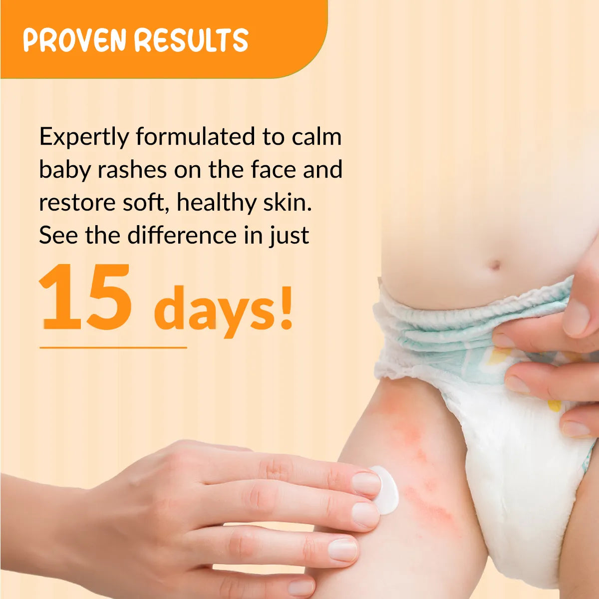 Fixderma Hoopoe Diaper Rash Cream, 50g - Image 4 - Buy from Indicrest