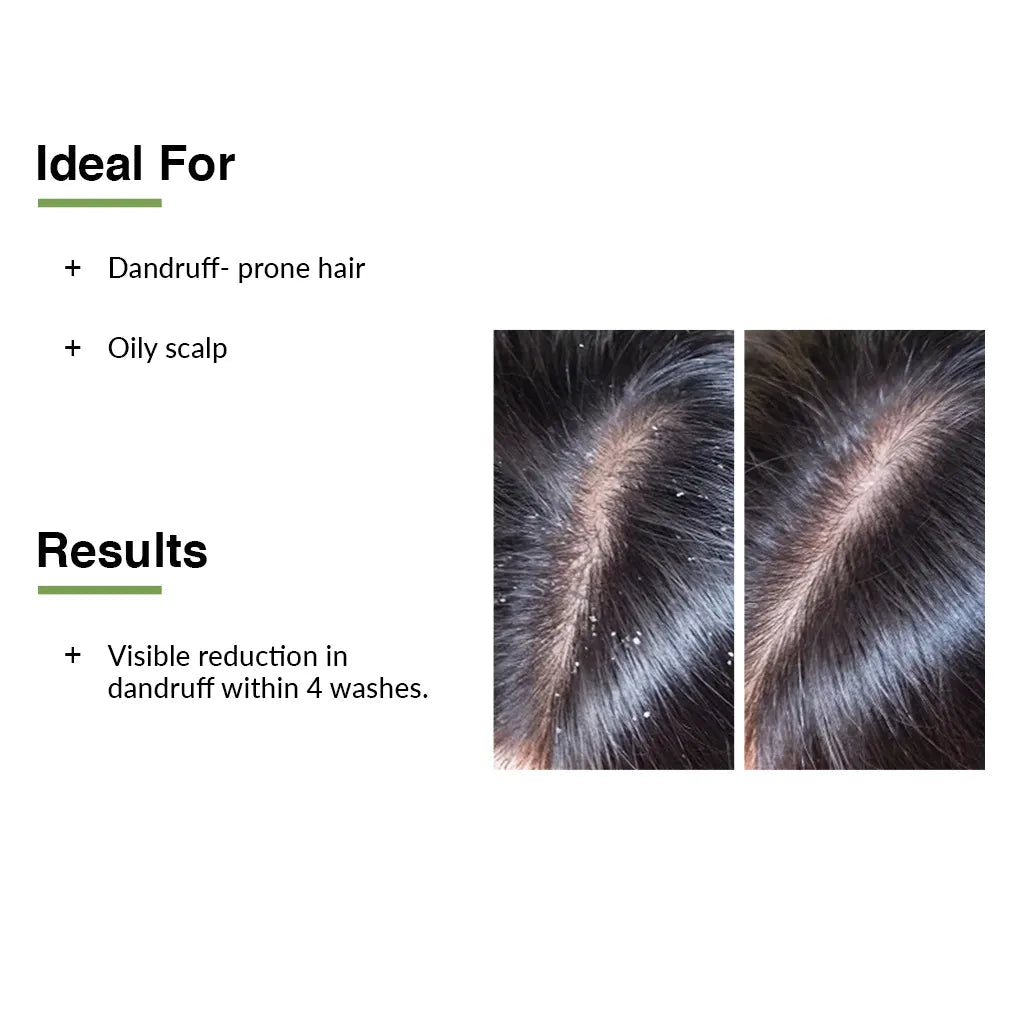 Fixderma Kairfoll Anti Dandruff Shampoo | Relieves Flakes & Scalp Irritation From the First Wash, 100ml - Image 3 - Buy from Indicrest