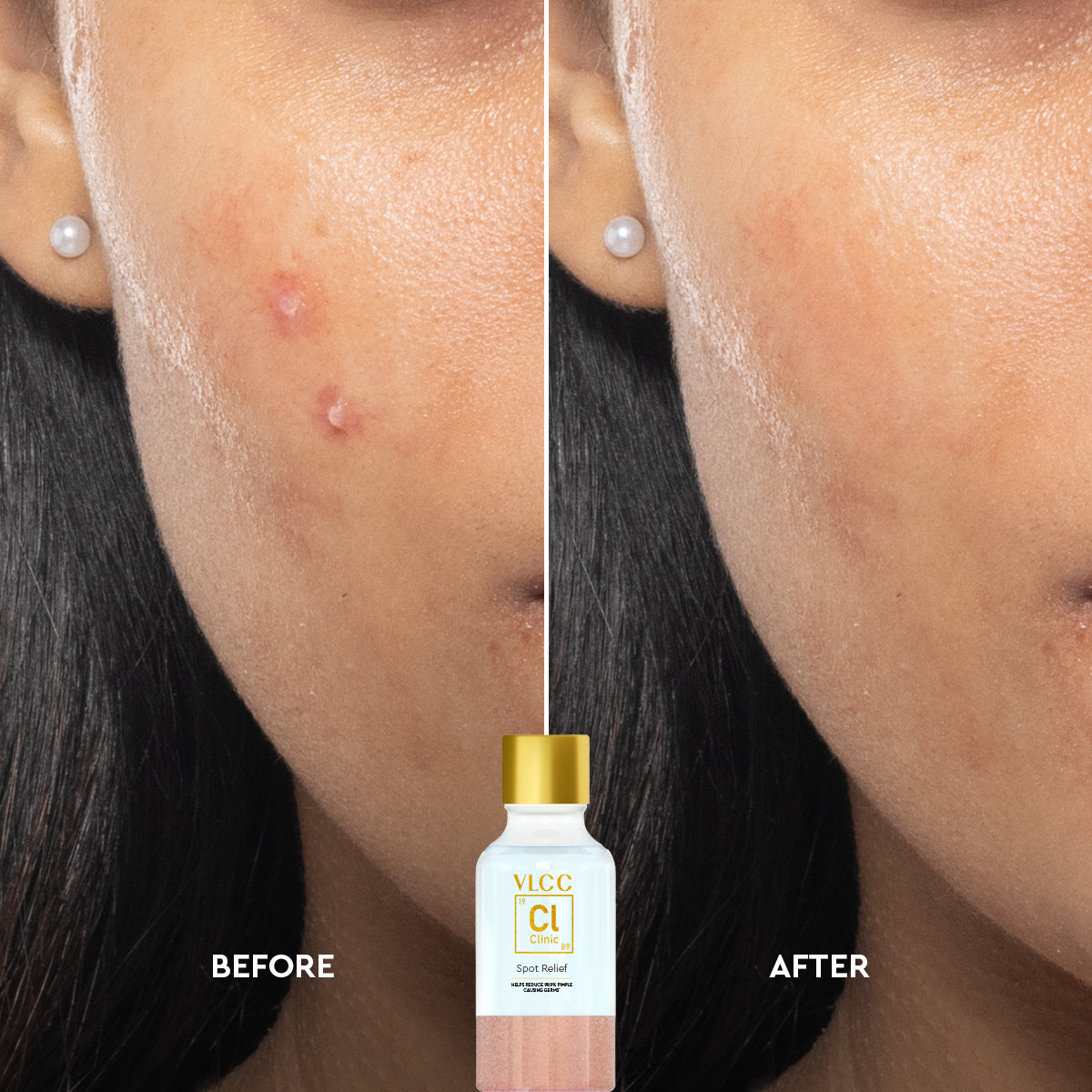 VLCC Spot Relief - 30 ml - Dark Spot Reduction - Image 12 - Buy from Indicrest