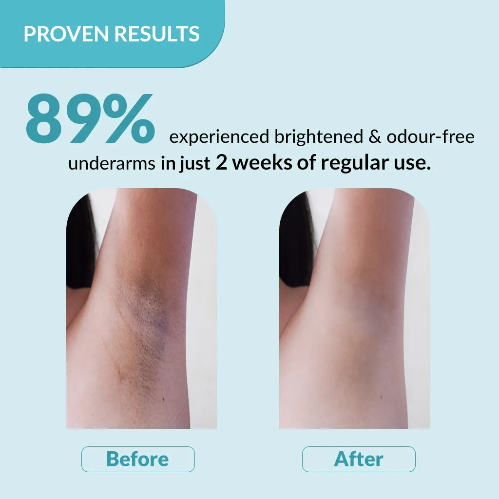 Fixderma Nigrifix Underarm Lightening Roll On | 6% AHA to Reduce Underarm Pigmentation in 2 Weeks, 60ml - Image 7 - Buy from Indicrest