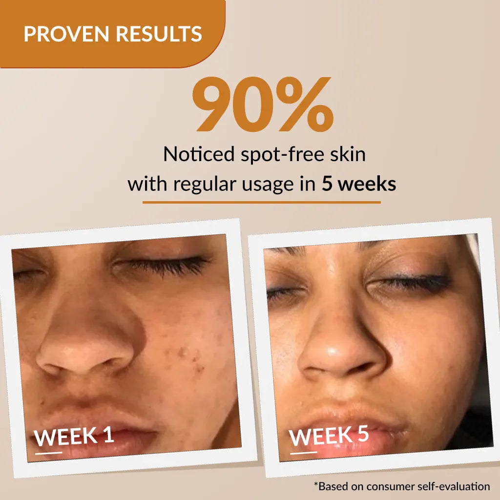Fixderma Skarfix-Plus Scar Removal Cream | Spot Treatment for Hyperpigmentation & Melasma, 15g - Image 4 - Buy from Indicrest
