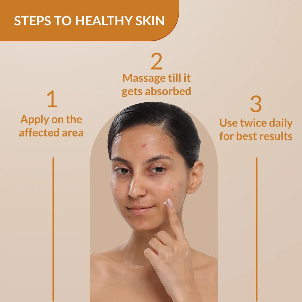 Fixderma Skarfix-Plus Scar Removal Cream | Spot Treatment for Hyperpigmentation & Melasma, 15g - Image 6 - Buy from Indicrest