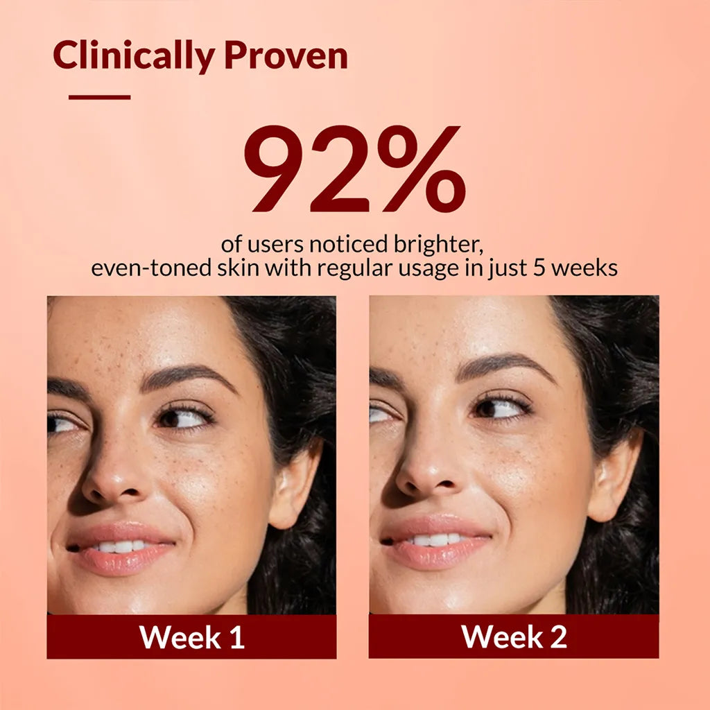 Fixderma Skarfix-TX Cream | Effective treatment for melasma and dark spots, 15g - Image 5 - Buy from Indicrest