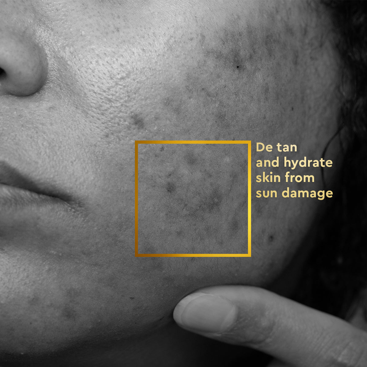 VLCC Skin Clarify and Protect Combo - Image 2 - Buy from Indicrest