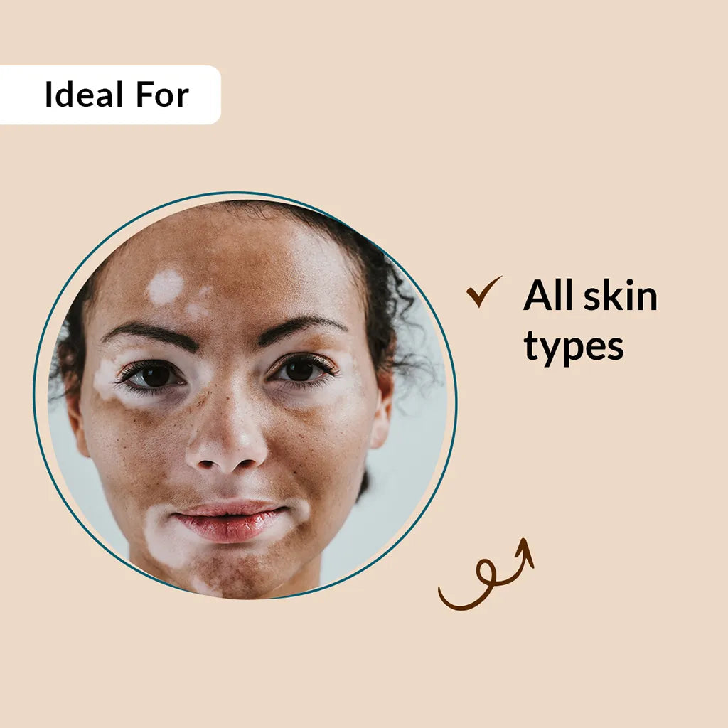 Fixderma Vitipause Gel | A pigment-regulating formula to improve vitiligo concerns, 15ml - Image 3 - Buy from Indicrest